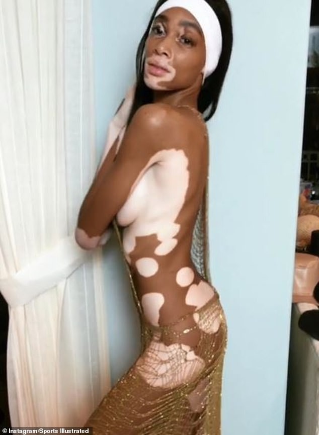 Winnie Harlow é a primeira modelo com vitiligo a posar para a Sports Illust...