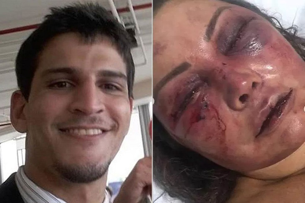 Vinicius e o rosto de Elaine após a agressão: ela sente dore até hoje — Foto: Reprodução/Instagram