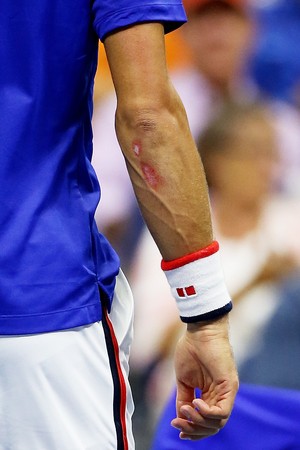 Djokovic braço ralado na final US Open (Foto: Getty Images) Djokovic braço ralado na final US Open (Foto: Getty Images)