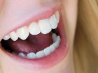 Seis hábitos que podem estragar seus dentes