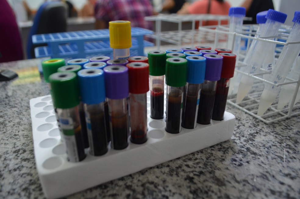 Exames de sangue devem ser feitos para detectar casos de hepatite — Foto: Victor Vidigal/G1