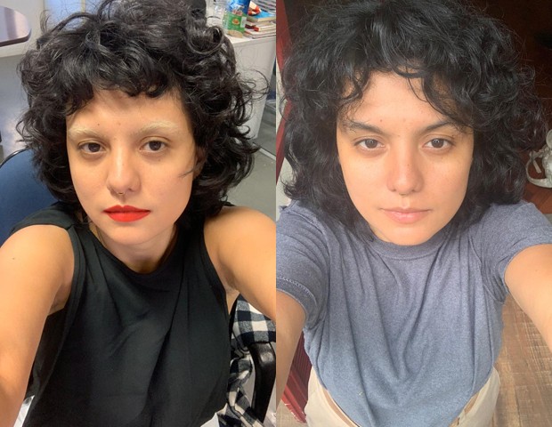 Karen Ka mostrando o antes e depois de sua cicatriz (Foto: Acervo Pessoal)