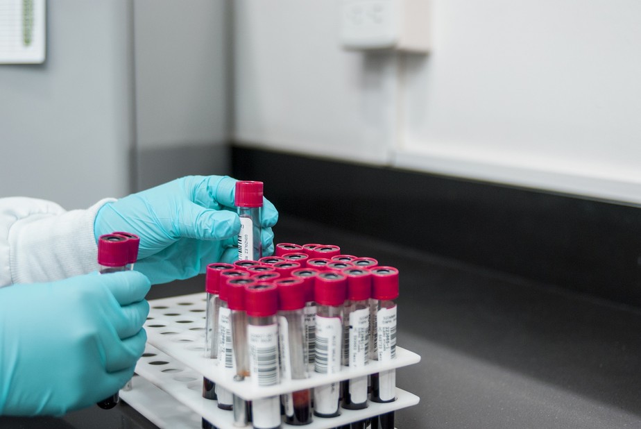 Amostras de sangue são analisadas em laboratório.