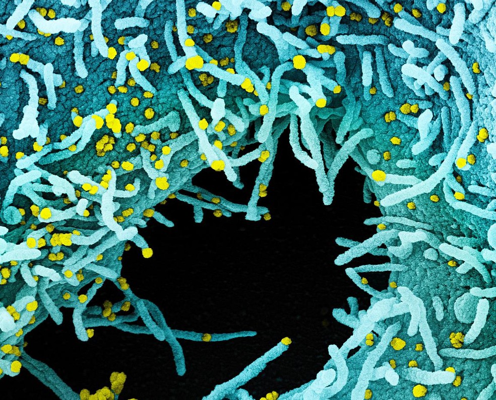 Micrografia eletrônica de uma célula infectada por partículas do SARS-CoV-2 (amarelo). A área preta é espaço extracelular entre as células. — Foto: Integrated Research Facility (IRF)/NIAID