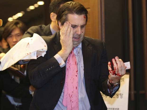 O embaixador dos EUA na Coreia do Sul, Mark Lippert, ficou ensanguentado após ataque de homem armado em Seul (Foto:  REUTERS/Yonhap )