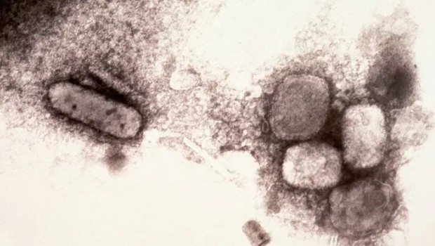 Visão microscópica do vírus que causa a varíola (Foto: GETTY IMAGES via BBC)
