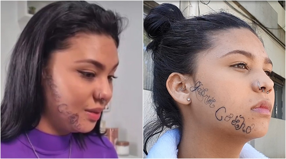 Tayane Caldas (montagem remoção da tatuagem feita à força pelo ex) — Foto: Pedro Melo/TV Vanguarda