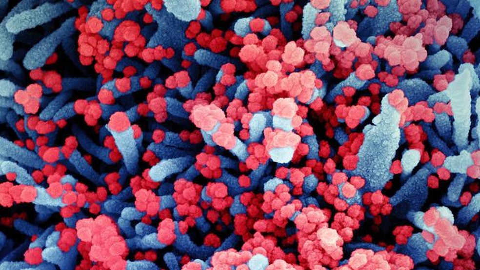 Imagem colorida artificialmente mostra célula, em azul, infectada pelo Sars CoV-2, em vermelho — Foto: NIAID