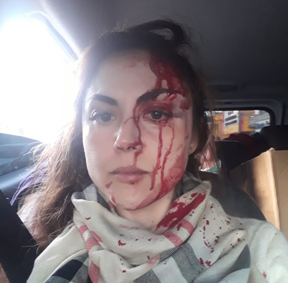 Procuradora foi agredida por diversas vezes no rosto por colega de prefeitura — Foto: Arquivo pessoal