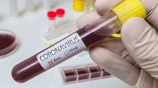 BBC - Paciente com coronavírus no Brasil deu entrada no hospital na segunda-feira (24) (Foto: Getty Images via BBC)