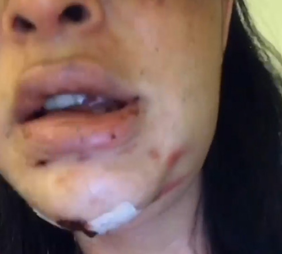 Mulher trans sofreu uma tentativa de homicídio na Zona Sul do Rio — Foto: Reprodução/ Redes sociais