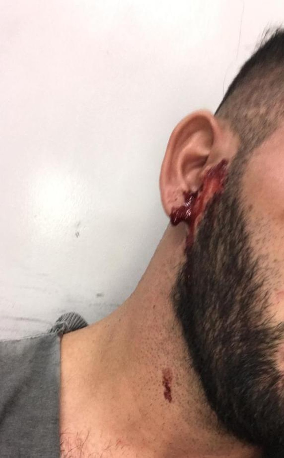 Motorista de aplicativo &eacute; agredido ap&oacute;s corrida na zona Norte de Natal &mdash; Foto: Cedida