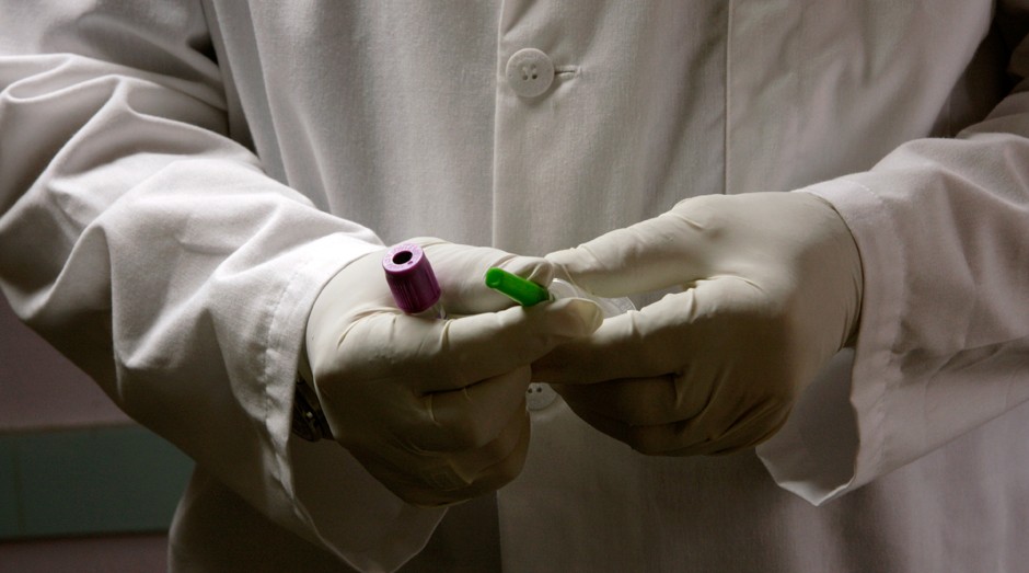 Teste pode detectar tumor em estágios iniciais do câncer (Foto: Flickr)