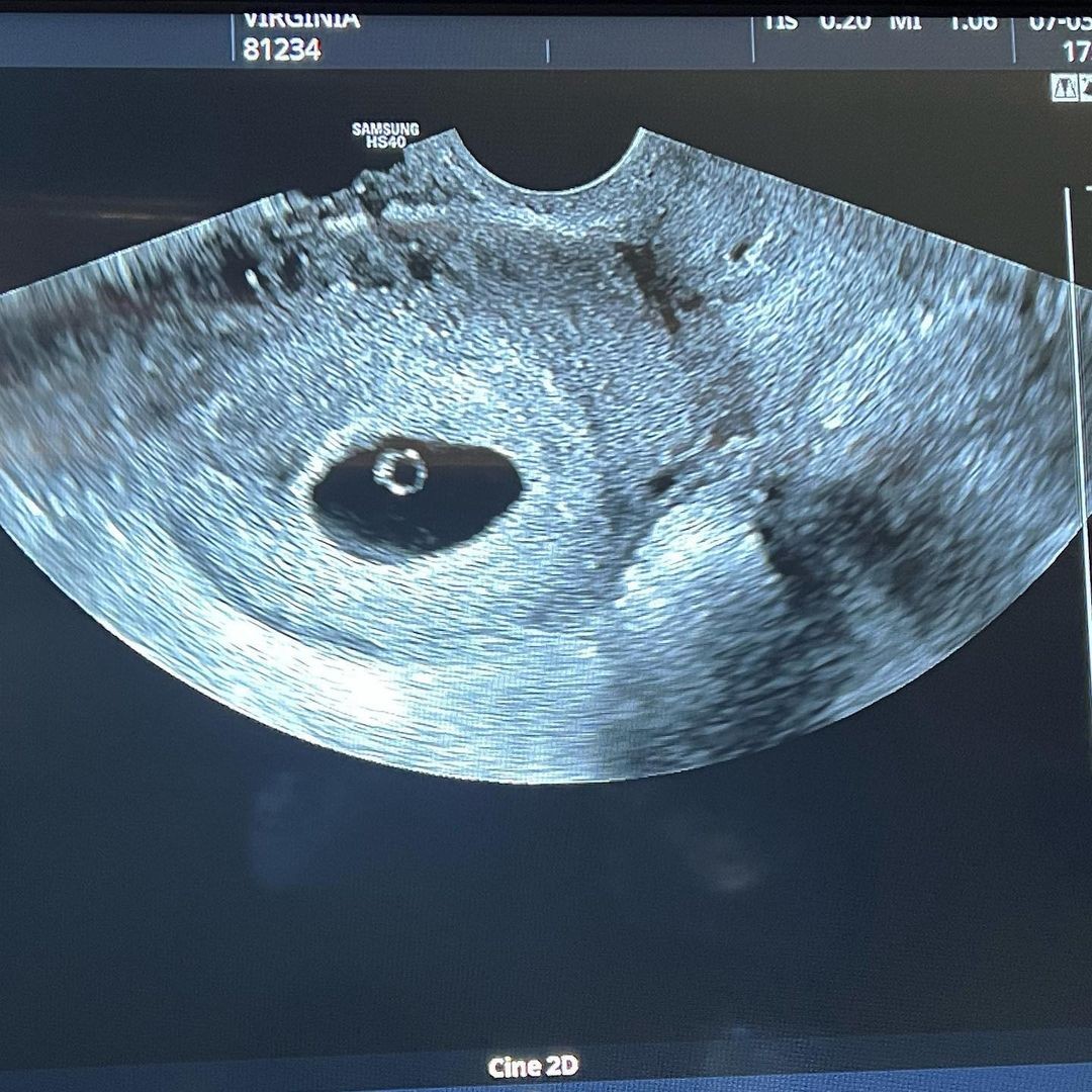 Virginia mostra ultrassom  (Foto: Reprodução/Instagram)