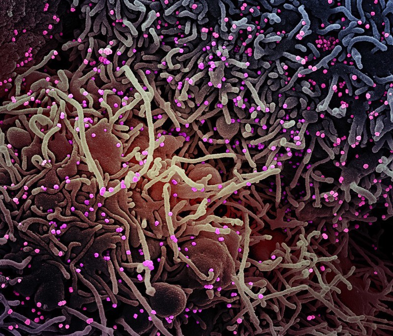 Micrografia eletrônica de varredura colorida de uma célula VERO E6 (roxa) após infecção por partículas do vírus Sars-COV-2 (rosa), que foram isoladas de uma amostra de paciente (Foto: NIAID)
