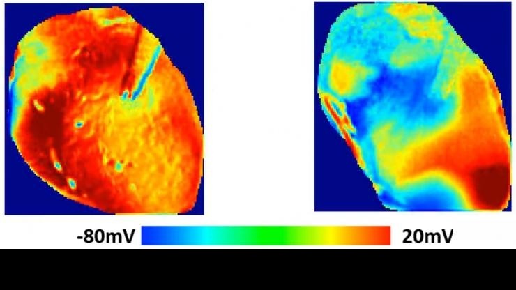 Estudo mostra como hidroxicloroquina afeta o ritmo do coração (Foto: Georgia Tech)