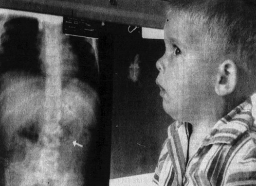 Brian Haines, de 2 anos, observa sua radiografia