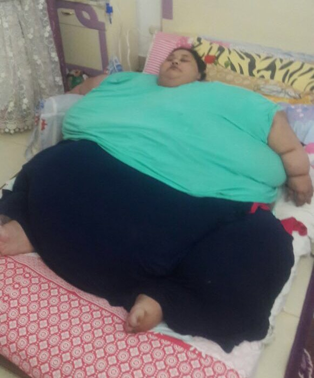 Mulher Mais Gorda Do Mundo Fará Cirurgia De Redução Do Estômago Na Índia Bem Estar G1