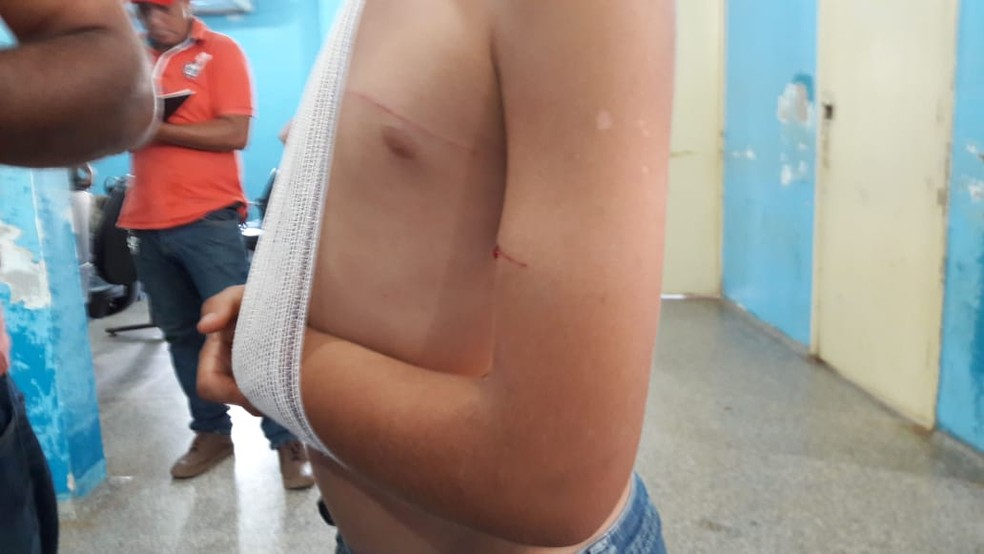 CrianÃ§a foi atingida por facÃ£o no braÃ§o durante ataque â Foto: LÃ­via Costa/G1
