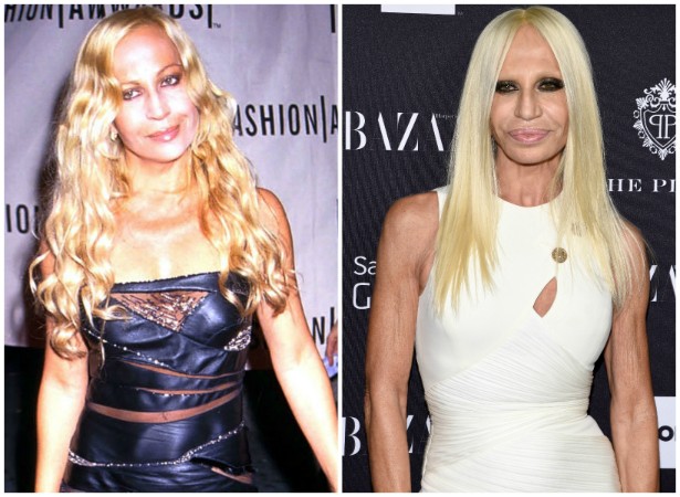 A estilista e empresária Donatella Versace em maio de 1999 e em setembro de 2014. (Foto: Getty Images)