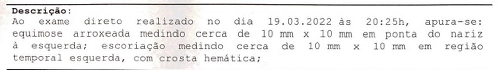 Laudo de corpo de delito aponta les�es corporais em lutador do Flamengo � Foto: Reprodu��o