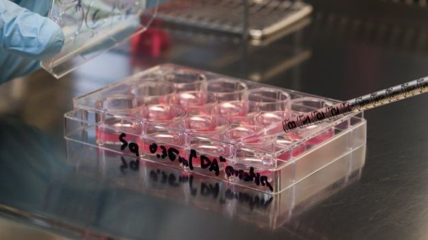 BBC - Estudo gerou as chamadas células tronco pluripotente induzidas (iPSCs, na sigla em inglês) (Foto: Getty Images via BBC News)