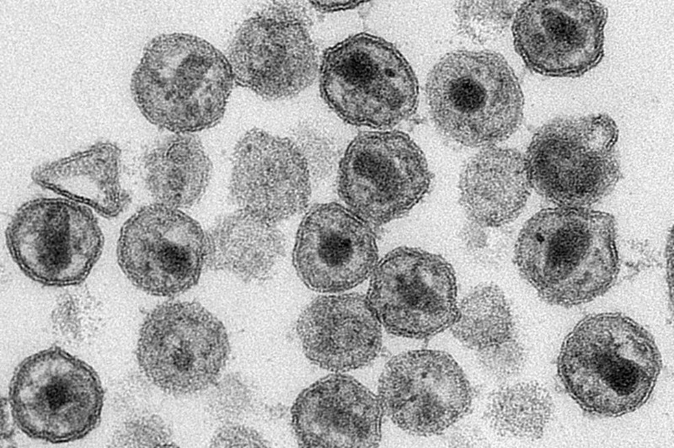 Células do vírus HIV (viriões), em imagem microscópica produzida em 2011 — Foto: Maureen Metcalfe, Tom Hodge/CDC/AP