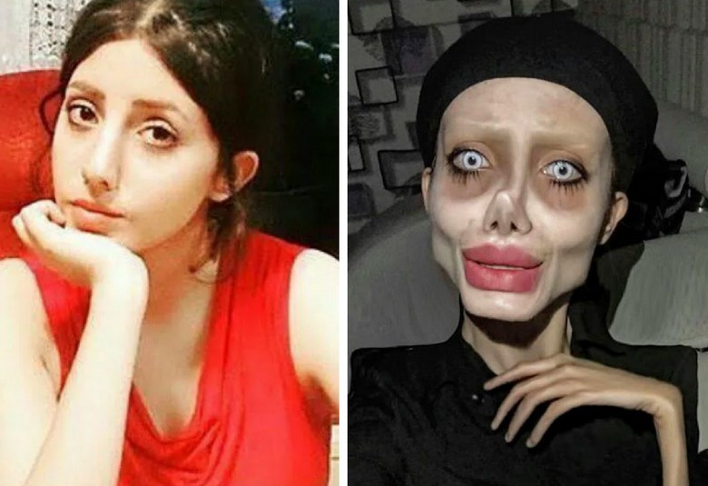 A jovem iraniana Sahar Tabar antes e depois dos procedimentos para ficar igual a Angelina Jolie (Foto: Instagram)