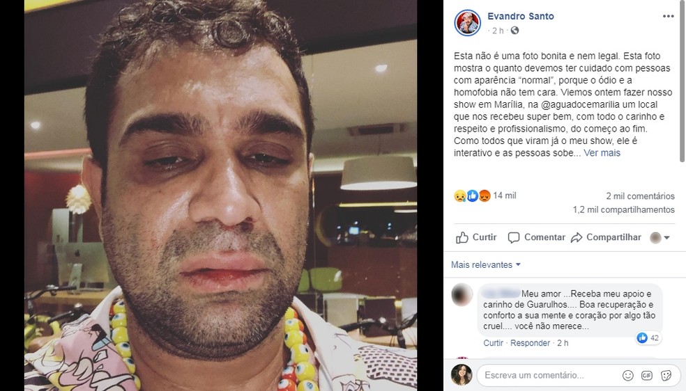Evandro Santo, ex-Pânico, relata agressão após show em Marília: 'Homofobia e covardia' — Foto: Facebook/Reprodução