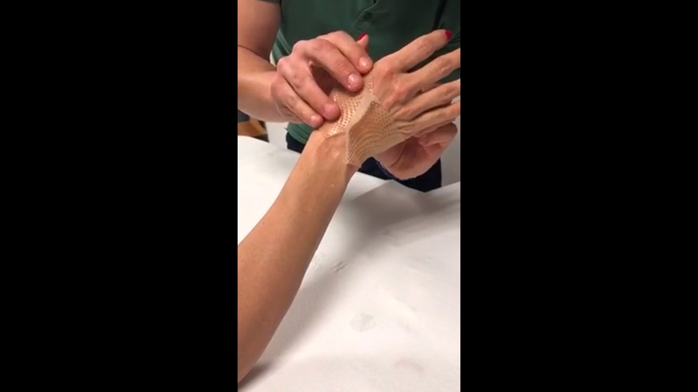 A atriz Pamela Anderson sendo atendida por um médico em decorrência de ferimentos nas mãos decorrentes de uma suposta agressão do jogador de futebol Adil Rami (Foto: Vimeo)