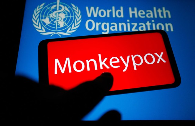 UKRAINE - 2022/05/21: In this photo illustration, the word Monkeypox is seen on the screen of a smartphone with the World Health Organization (WHO) logo in the background. (Photo Illustration by Pavlo Gonchar/SOPA Images/LightRocket via Getty Images) (Foto: SOPA Images/LightRocket via Gett)
