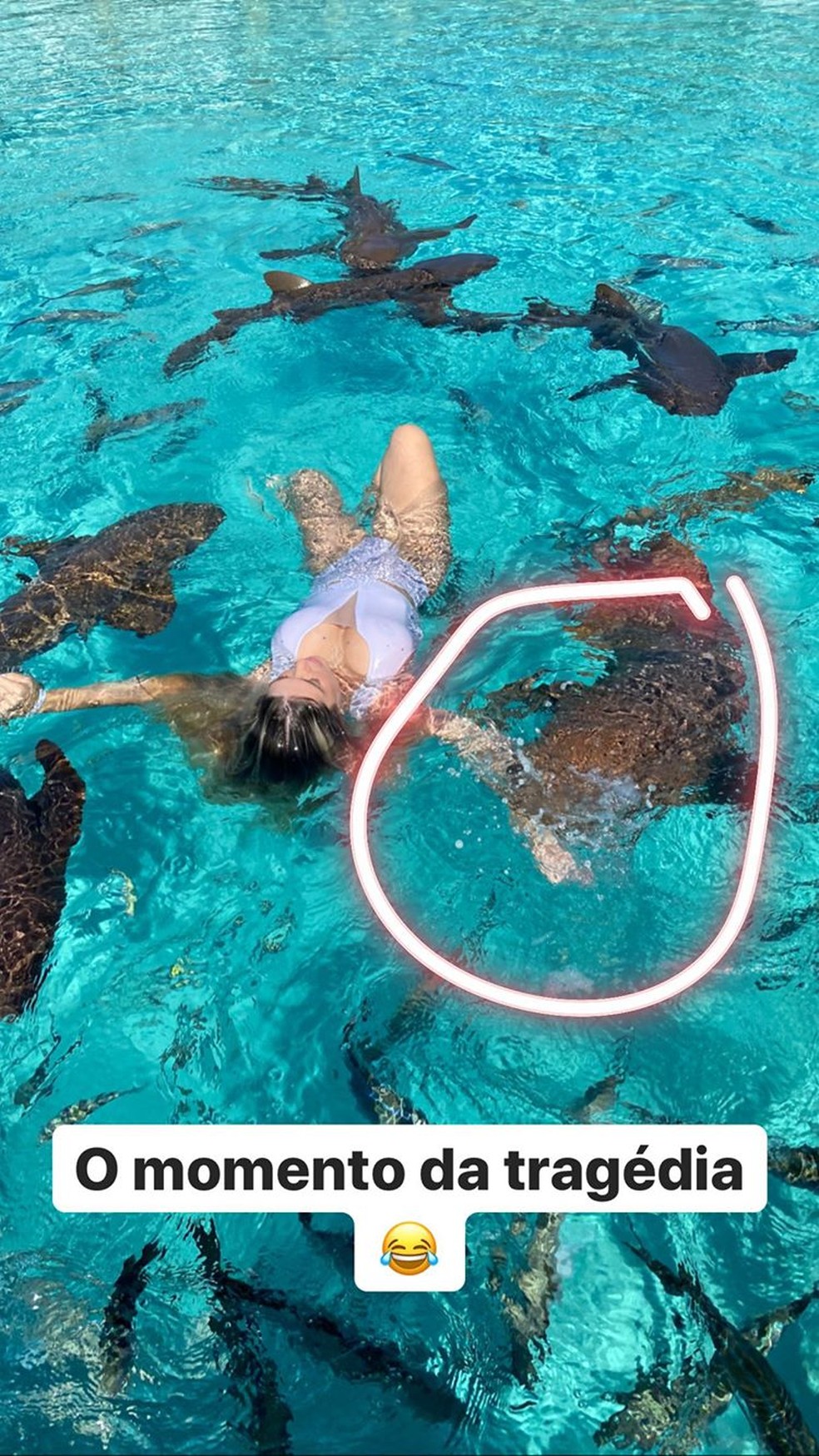 Influencer Ana Bruna Avila é mordida por tubarão nas Bahamas — Foto: Reprodução/Instagram