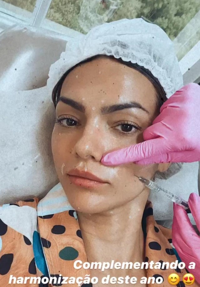 Kelly Key faz novo procedimento estético facial (Foto: Reprodução/Instagram )