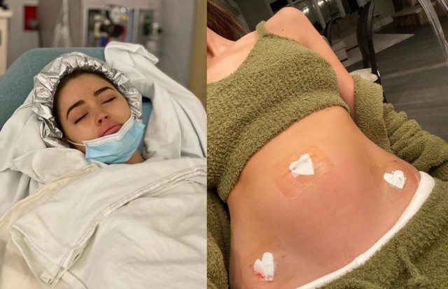 Ex-Miss Universo, Olivia Culpo compartilha cirurgia de endometriose: "criar mais consciência sobre esta doença" (Foto: Reprodução)