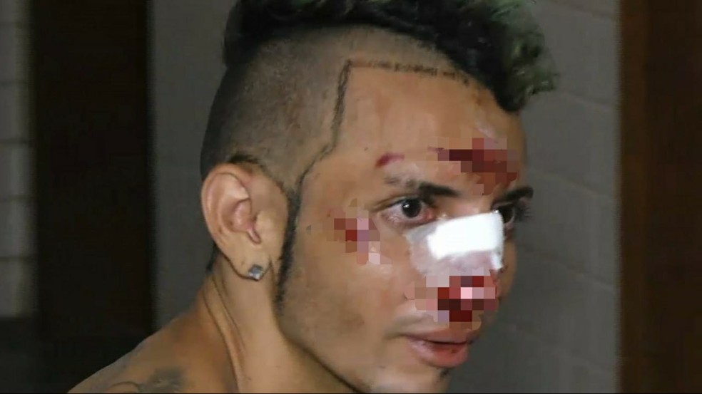 Fábio Daniel Paes Cardoso, de 23 anos, foi agredido por moradores após tentar assaltar duas pessoas em Santarém — Foto: Reprodução/TV Tapajós 