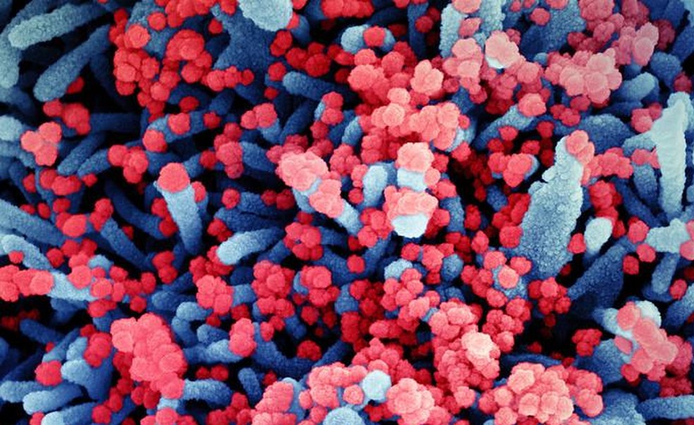 Imagem colorida artificialmente mostra célula, em azul, infectada pelo Sars CoV-2, em vermelho — Foto: NIAID