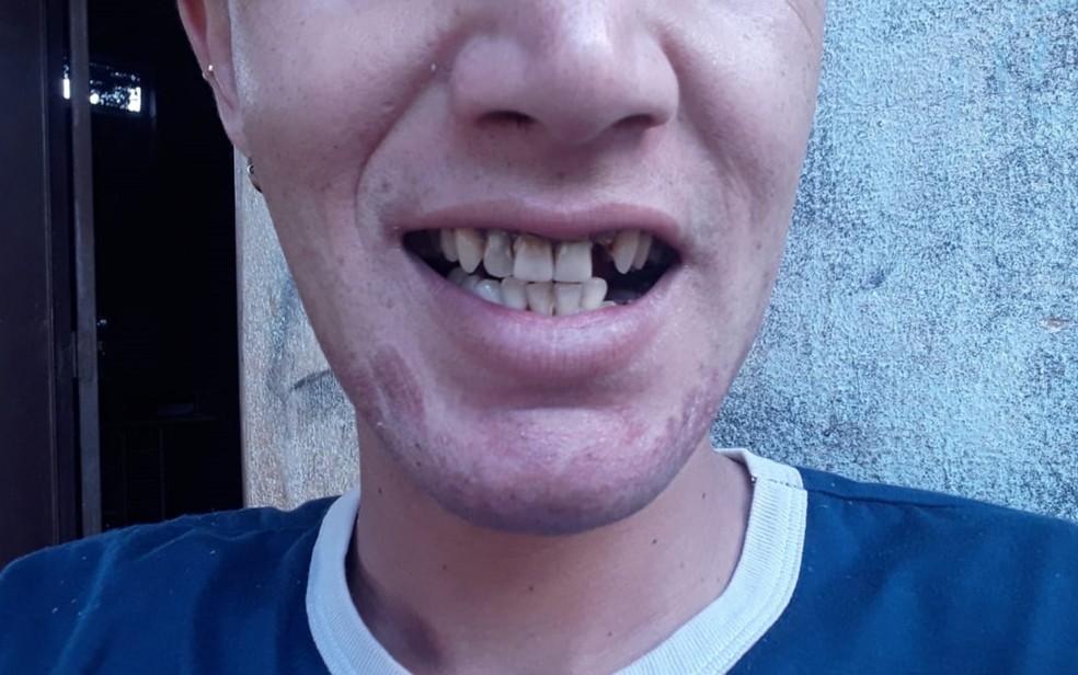 Anjelo Rocha pede ajuda para conseguir fazer tratamento dentário e voltar a fazer shows — Foto: Anjelo Rocha/Arquivo Pessoal