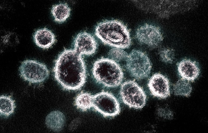 coronavirus (Foto: NIAID-NIH)