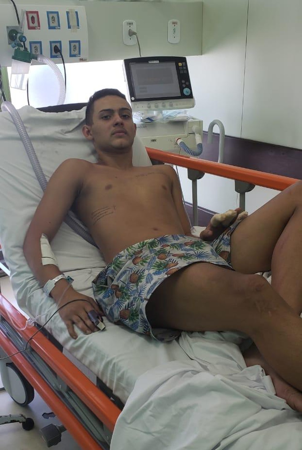 Cauan foi um dos jogadores feridos no incÃªndio â€” Foto: ReproduÃ§Ã£o