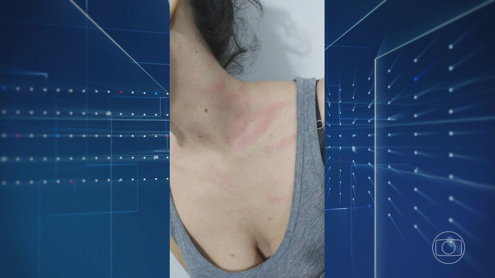 Gabriella Micaretta Machado foi agredida pelo ex-marido — Foto: Jornal Nacional