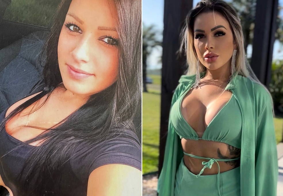 J&eacute;ssica Juliane antes e depois de pl&aacute;sticas &mdash; Foto: Divulga&ccedil;&atilde;o