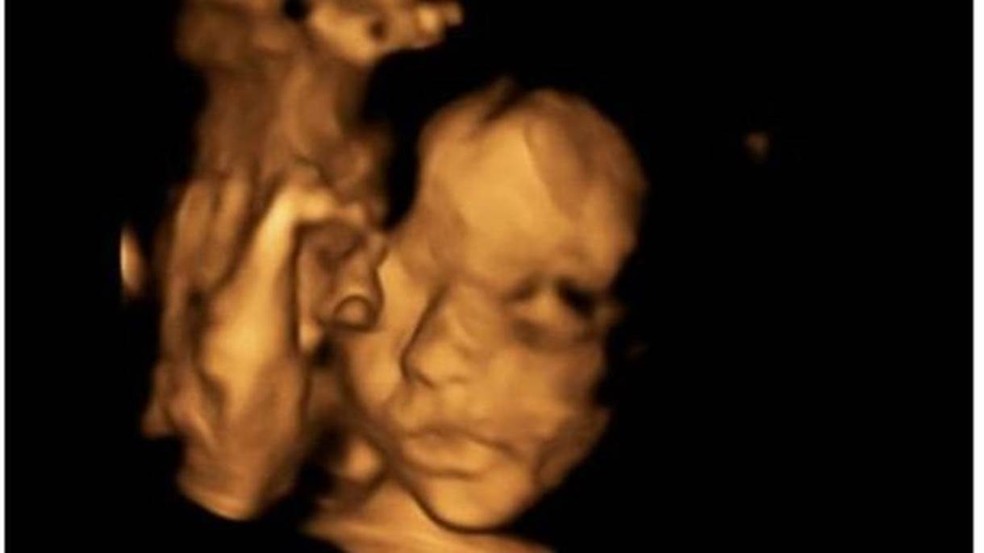 O nascimento da filha de Bethan e Keiron Simpson, Eloise, está previsto para abril — Foto: Bethan Simpson (via BBC)