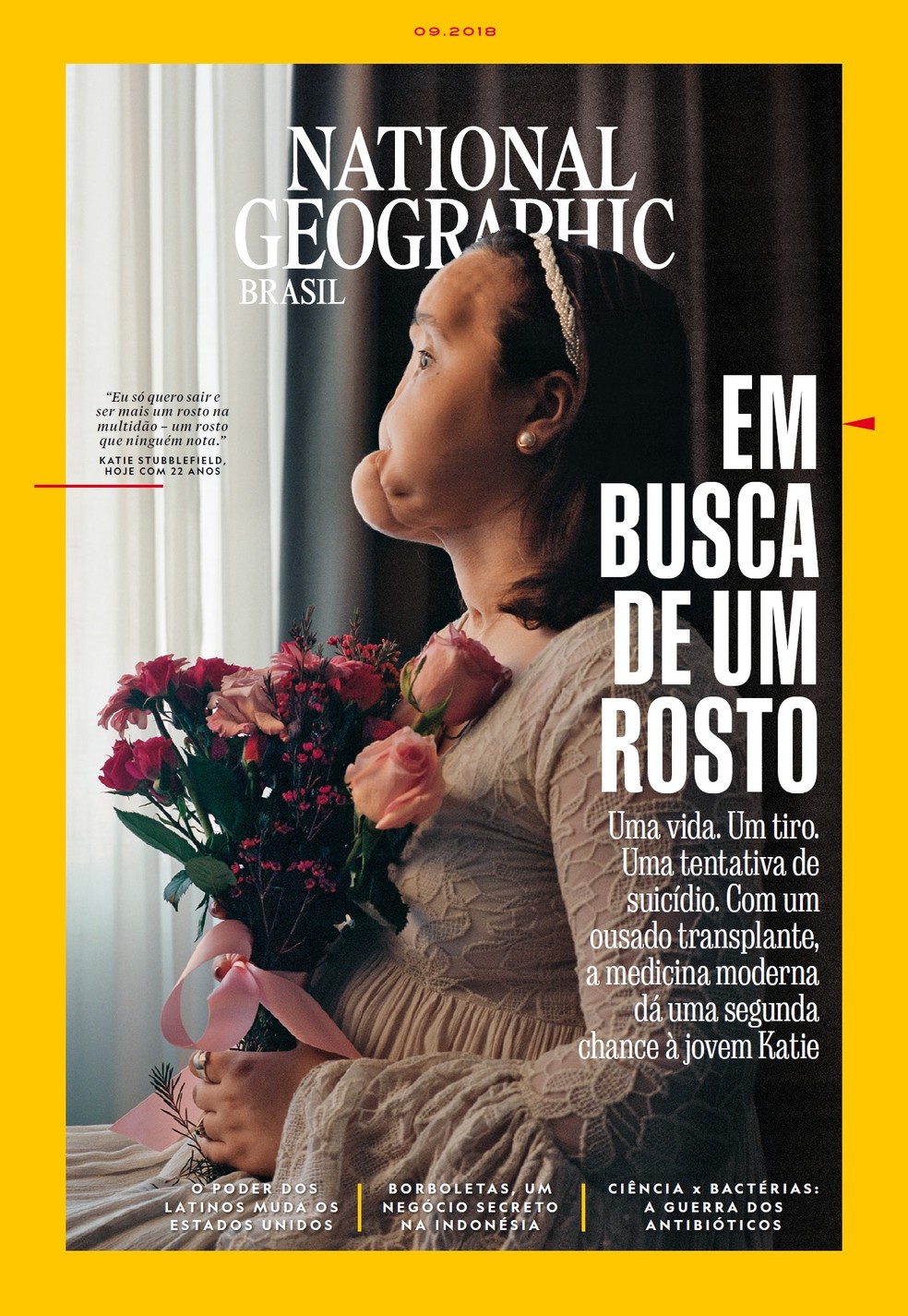 Capa da revista "National Geographic" acompanhou a história de Katie Stubblefield, a mais jovem receptora de um transplante de rosto da história dos EUA — Foto: Divulgação "National Geographic"