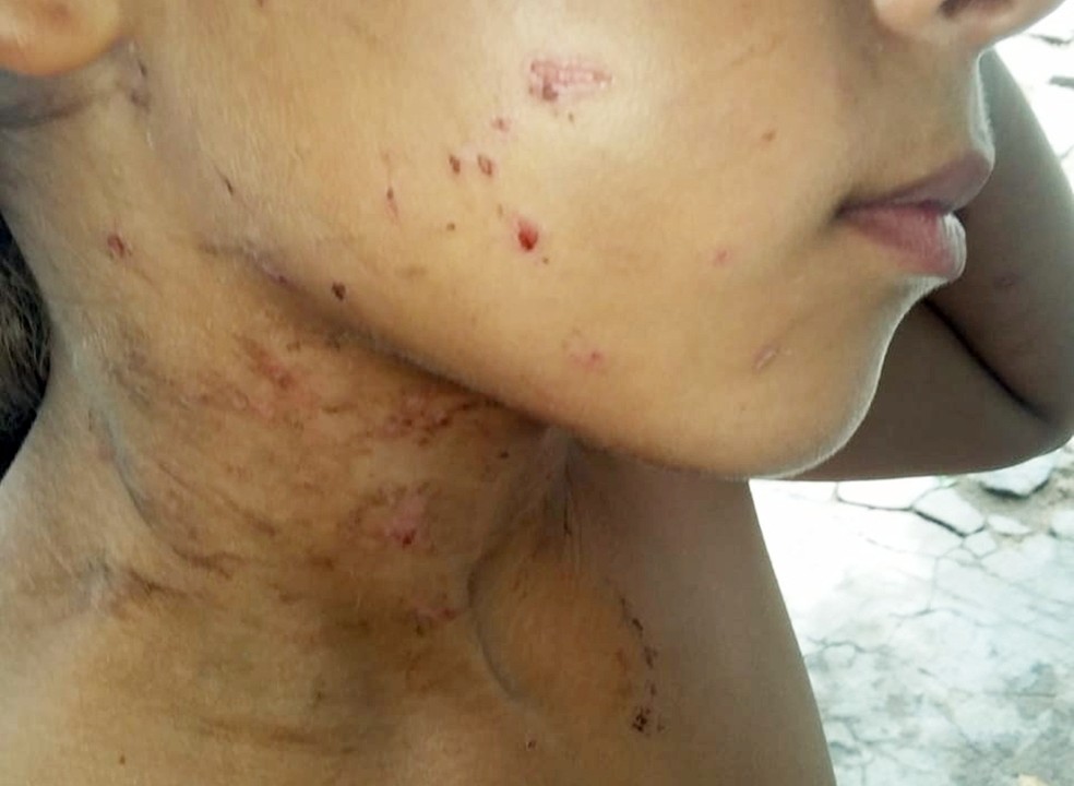 Menina foi agredida pela madrasta em SÃ£o Bento, no SertÃ£o da ParaÃ­ba â Foto: DivulgaÃ§Ã£o/PolÃ­cia Civil da ParaÃ­ba