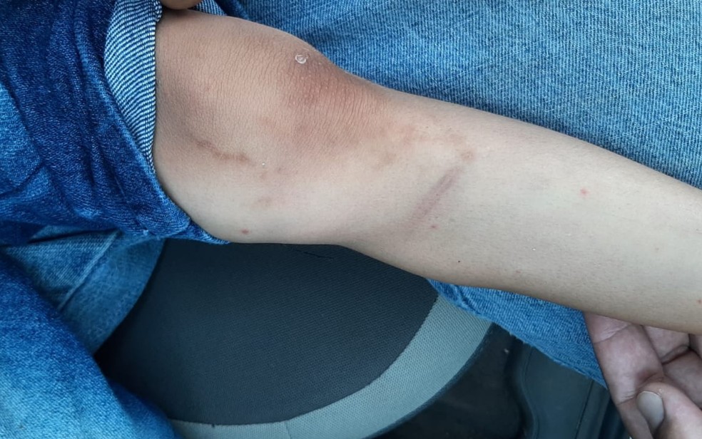 Criança com ferimentos na perna que teriam sido provocados pela mãe e padrasto em Mineiros, Goiás — Foto: Divulgação/Polícia Civil