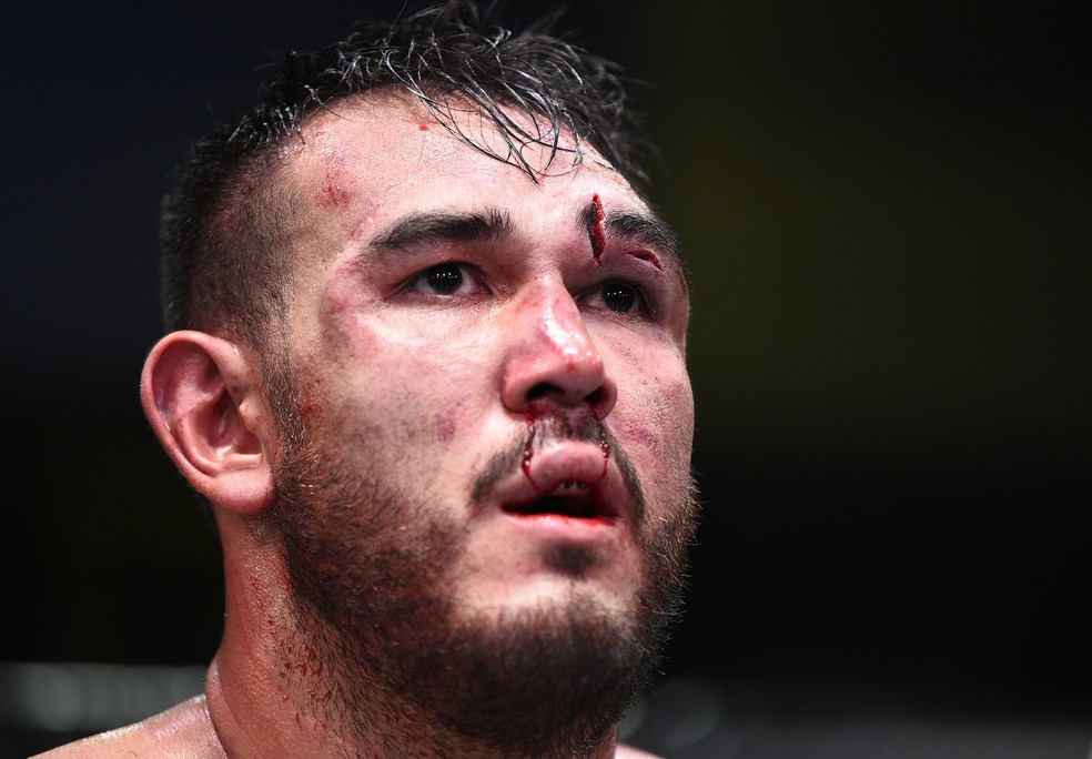 Augusto Sakai terminou com grandes ferimentos após a luta contra Alistair Overeem — Foto: Getty Images