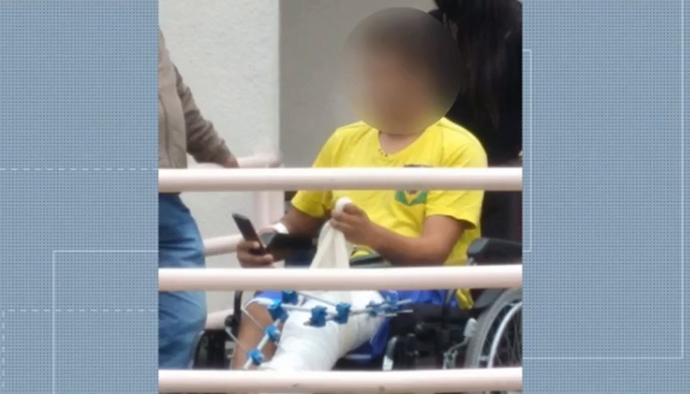 Uma das vítimas, de 16 anos, quebrou a perna — Foto: Reprodução/RPC 