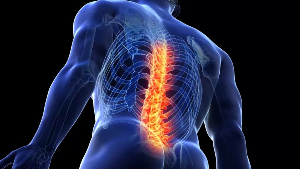 5 cosas que debes saber sobre el dolor de espalda |  salud