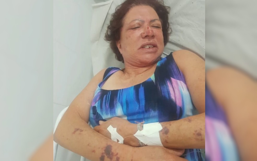 Ex-primeira-dama de Itaberaí Eleni Soares após ser assaltada e agredida pela segunda vez neste ano, em Goiás — Foto: Reprodução/TV Anhanguera