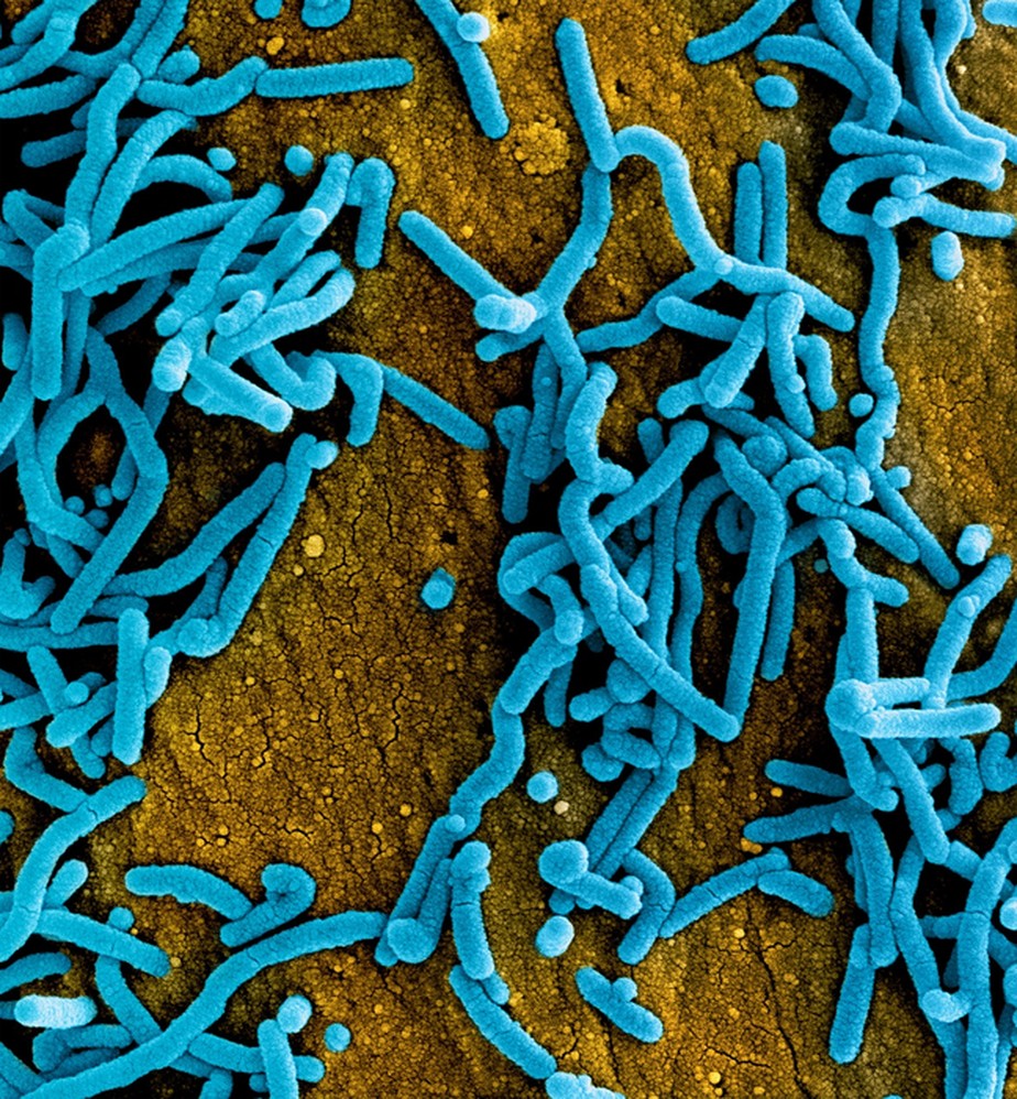 Micrografia eletrônica de varredura colorida das partículas do vírus Marburg (azul) aderidas à superfície das células VERO E6 infectadas (laranja).